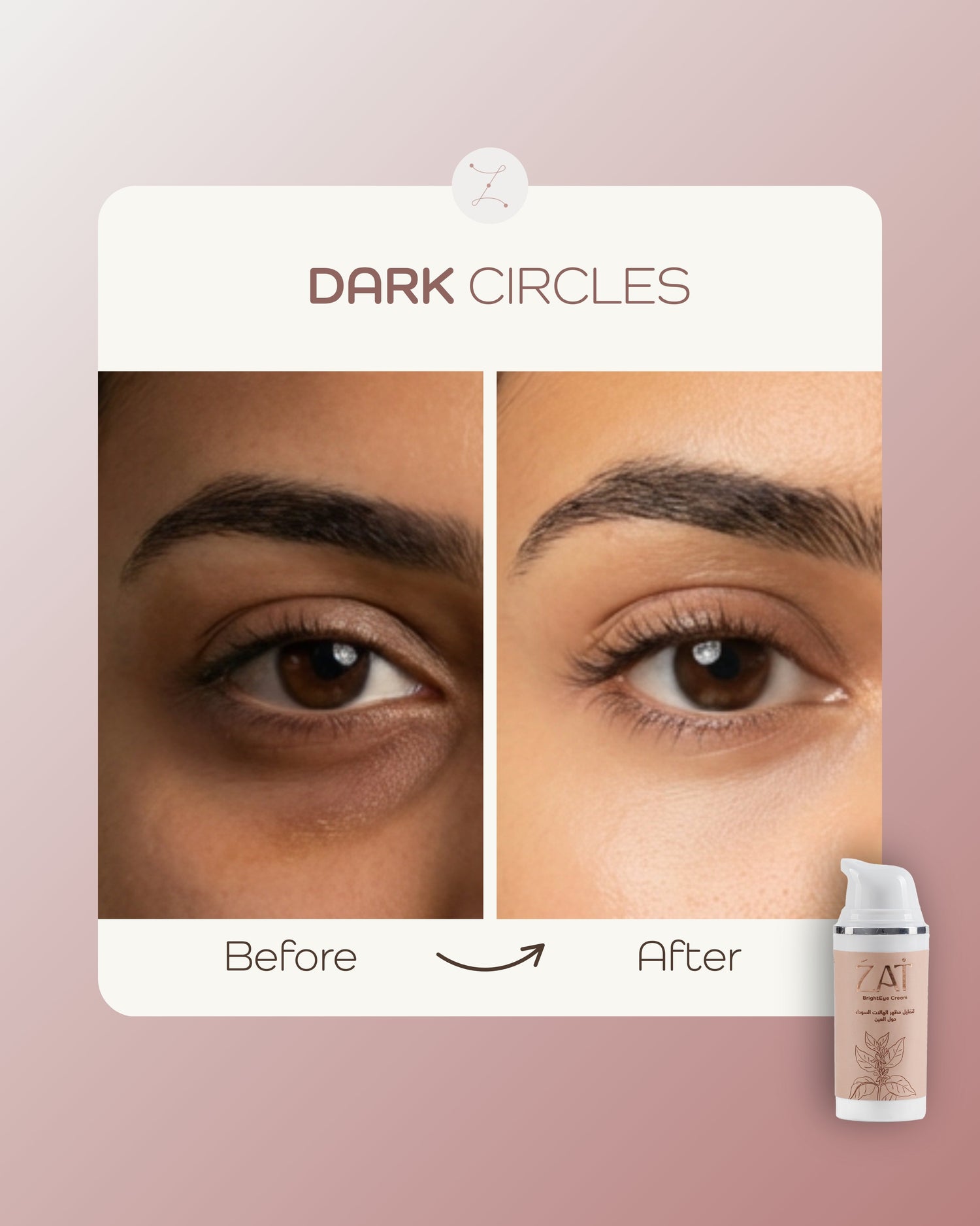 Dark Circles